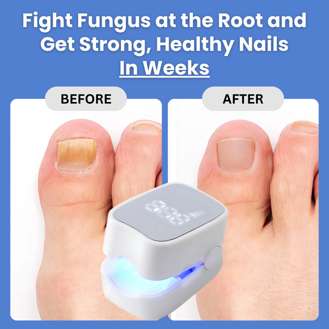Sunposus Pro ™ – Nail Fungus Laser Device Solution
