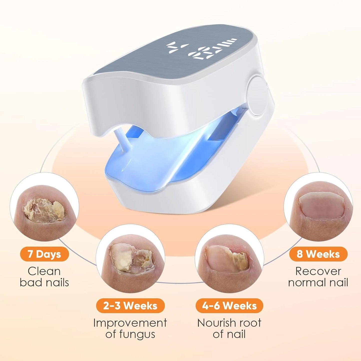 Sunposus Pro ™ – Nail Fungus Laser Device Solution